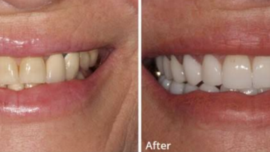 The Journey From Tooth Loss To Lasting Smile Restoration